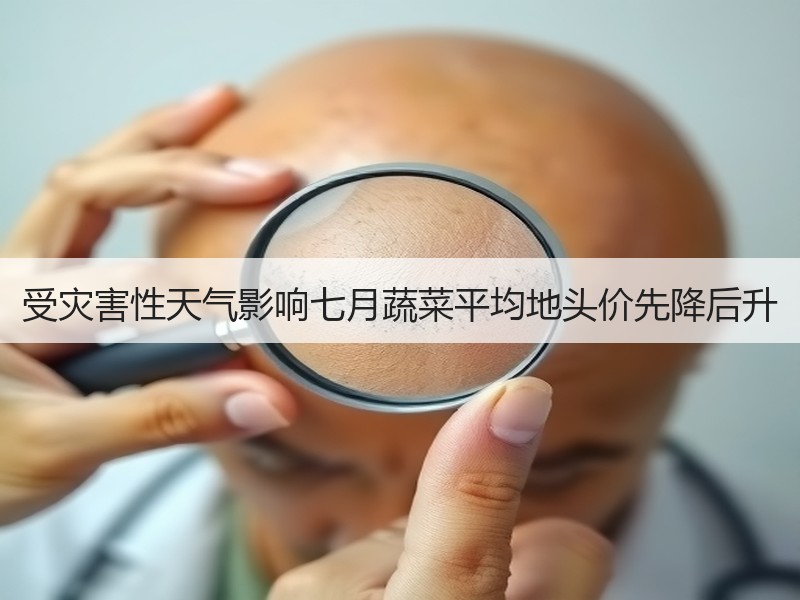 受灾害性天气影响七月蔬菜平均地头价先降后升